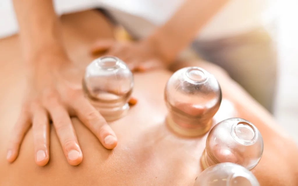 cupping